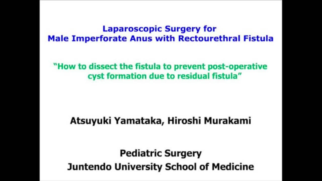 Laparoscopic Surgery for Male Imperforate Anus and Rectourethral Fistula:...