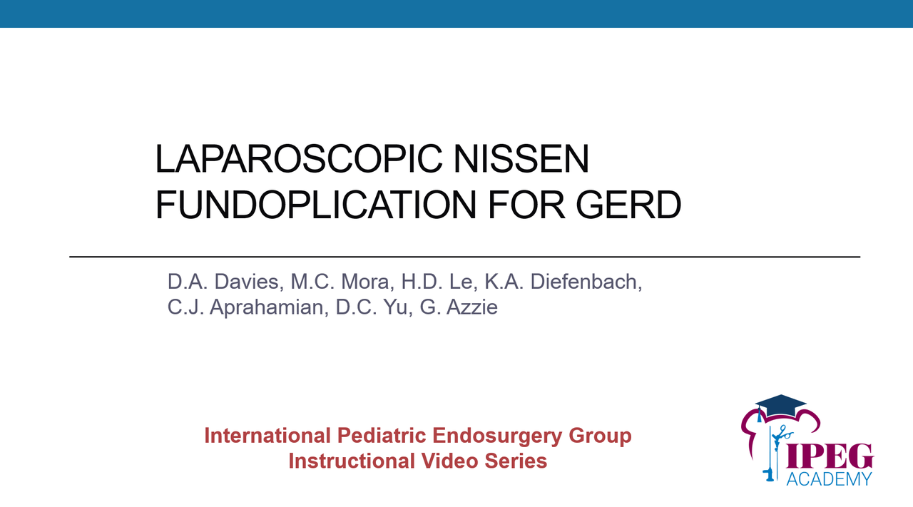 IPEG Academy: Laparoscopic Nissen Fundoplication for GERD