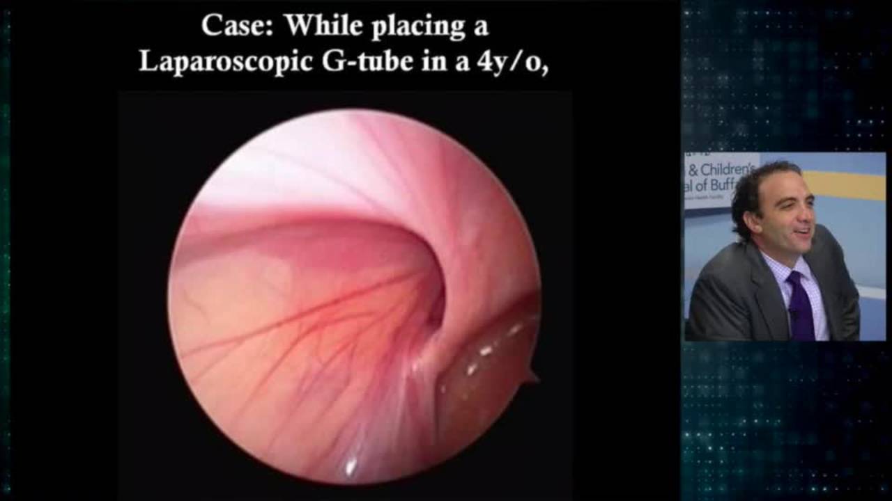 Groin Controversies: Update Course 2016