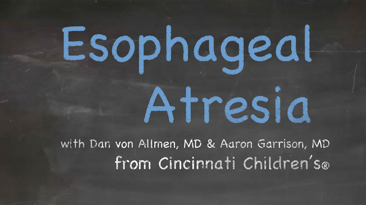 Esophageal Atresia in Brief: Presentation, Workup, Diagnosis, and Treatment
