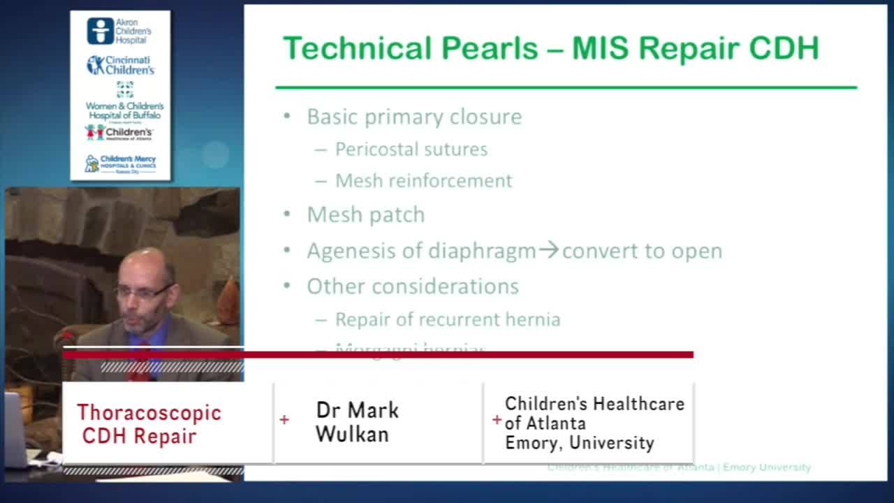 How I Do It Wulkan CDH