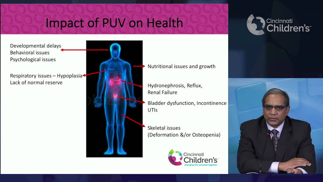 Importance of PUV Health