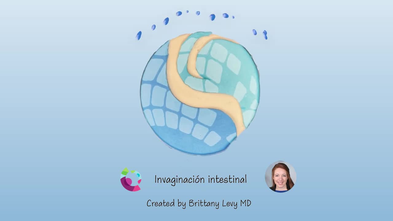 Invaginación Intestinal
