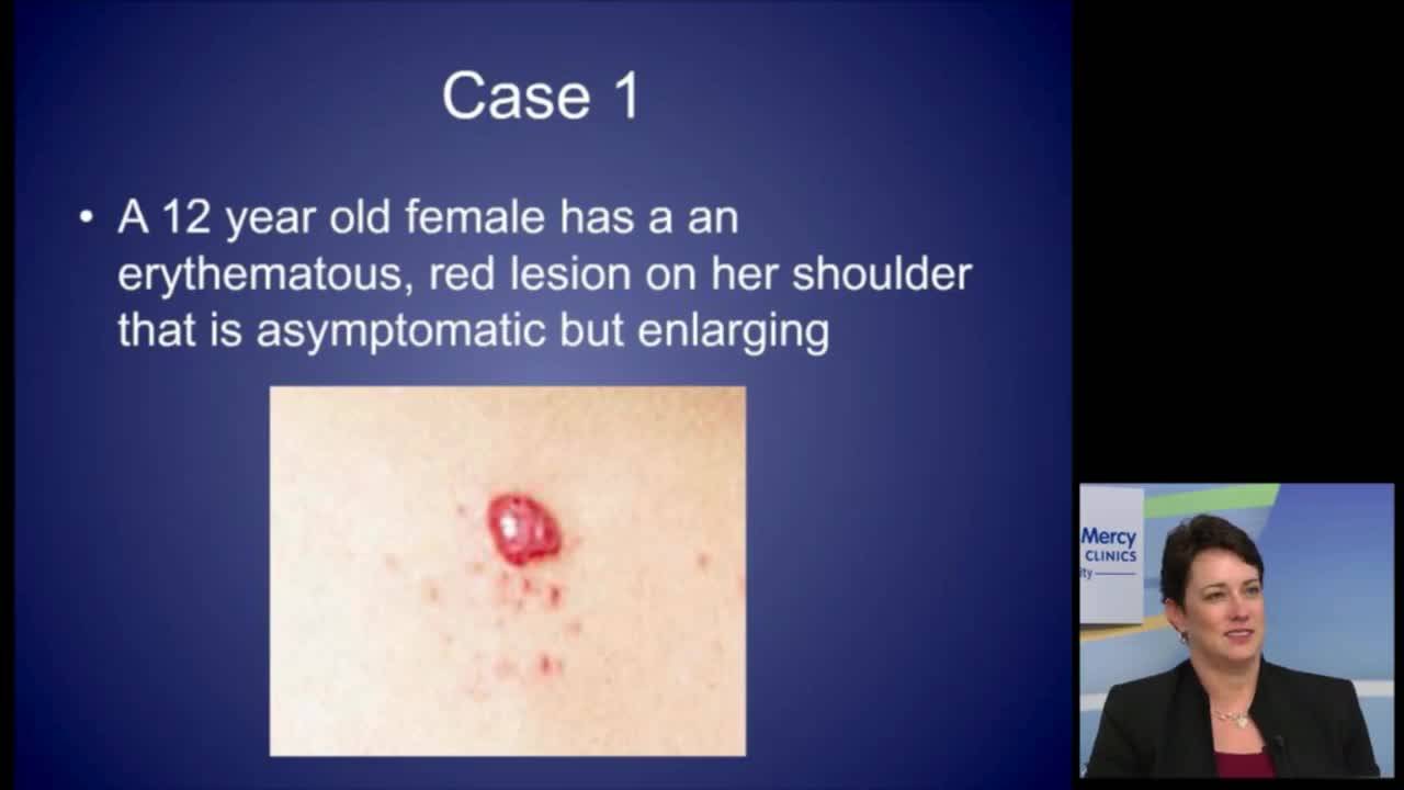 Lumps & Bumps: Soft Tissue Masses and Lesions