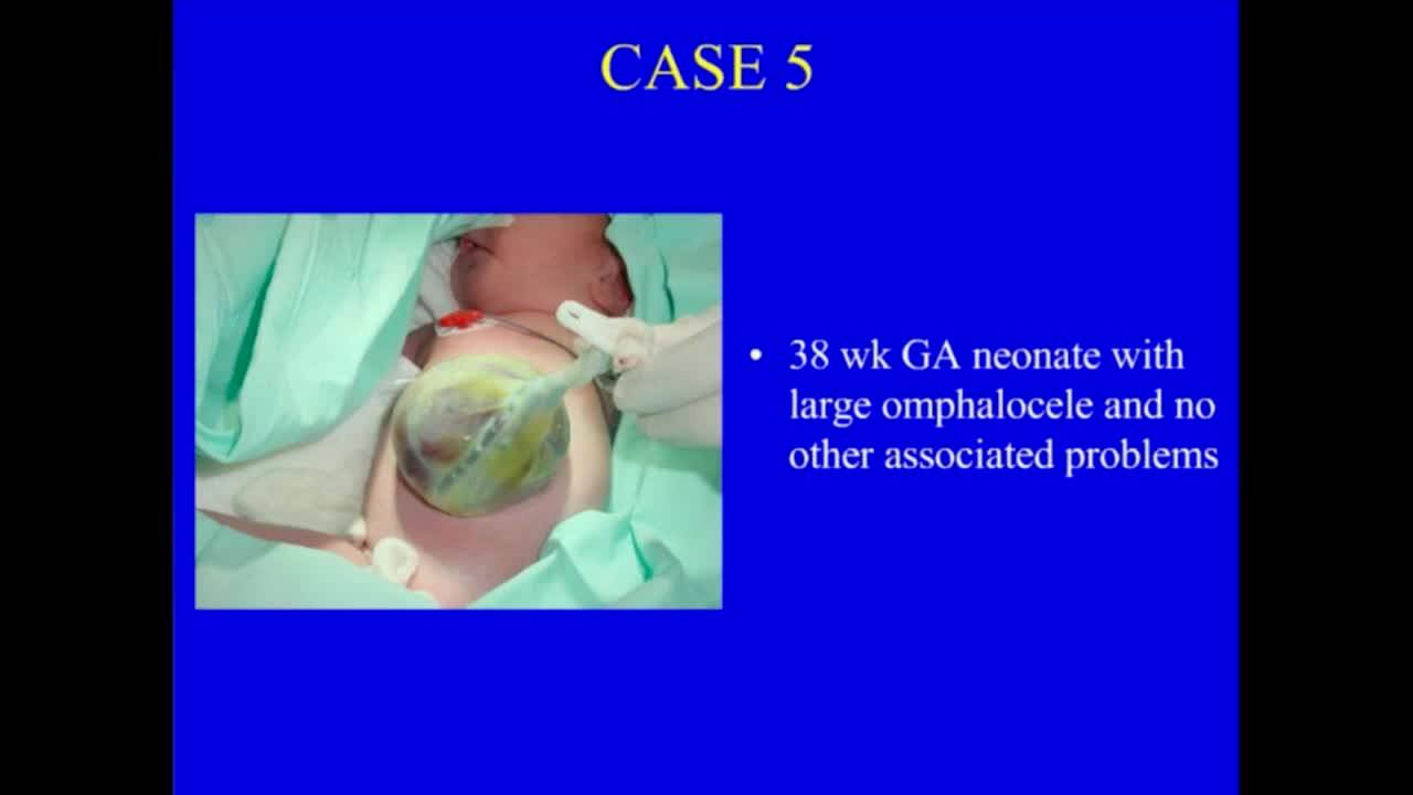 Abdominal Wall Defects