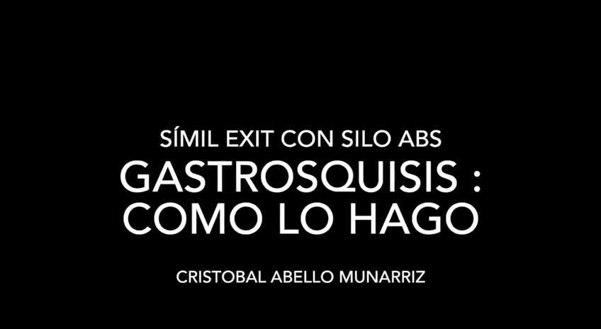 Silo ABS en simil Exit: ¿Como lo hago?