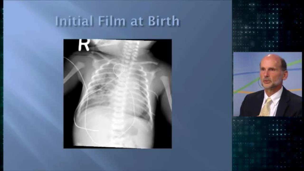 Congenital Cystic Lung Lesions: Update Course 2014