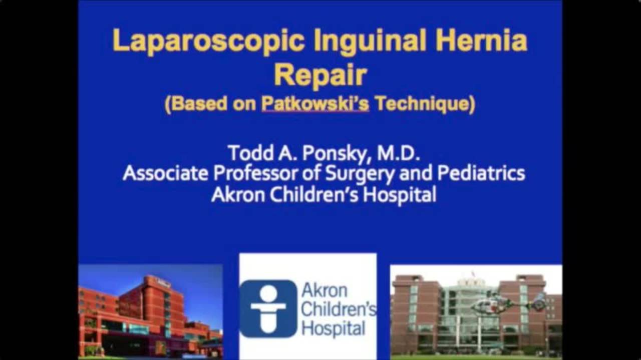 Tricks - Laparoscopic Hernia With Peritoneal Injury - Todd Ponsky