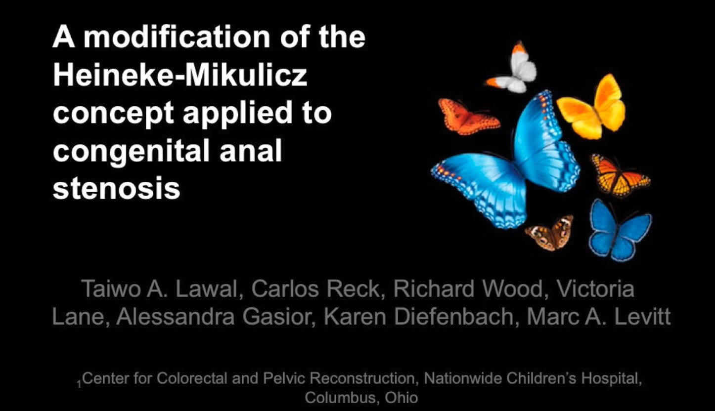 Heineken Mikulicz Congenital Stenosis Video (No audio)