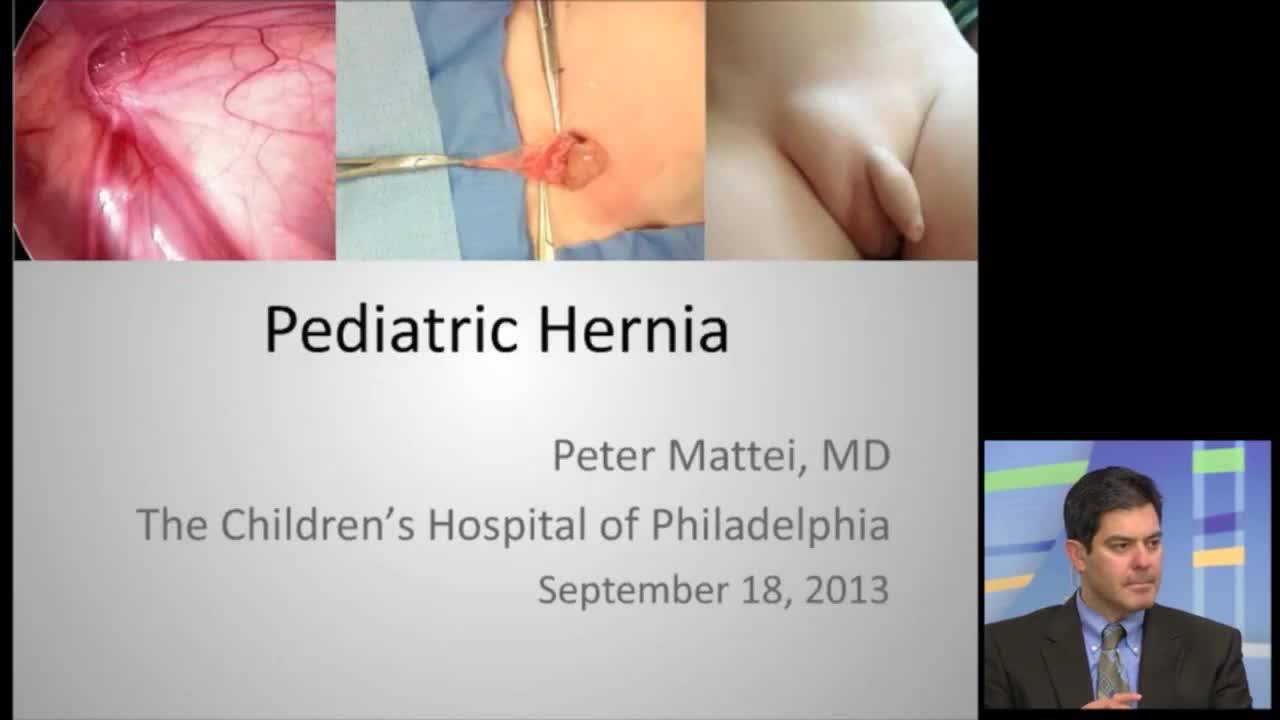 Pediatric Hernia - Peter Mattei