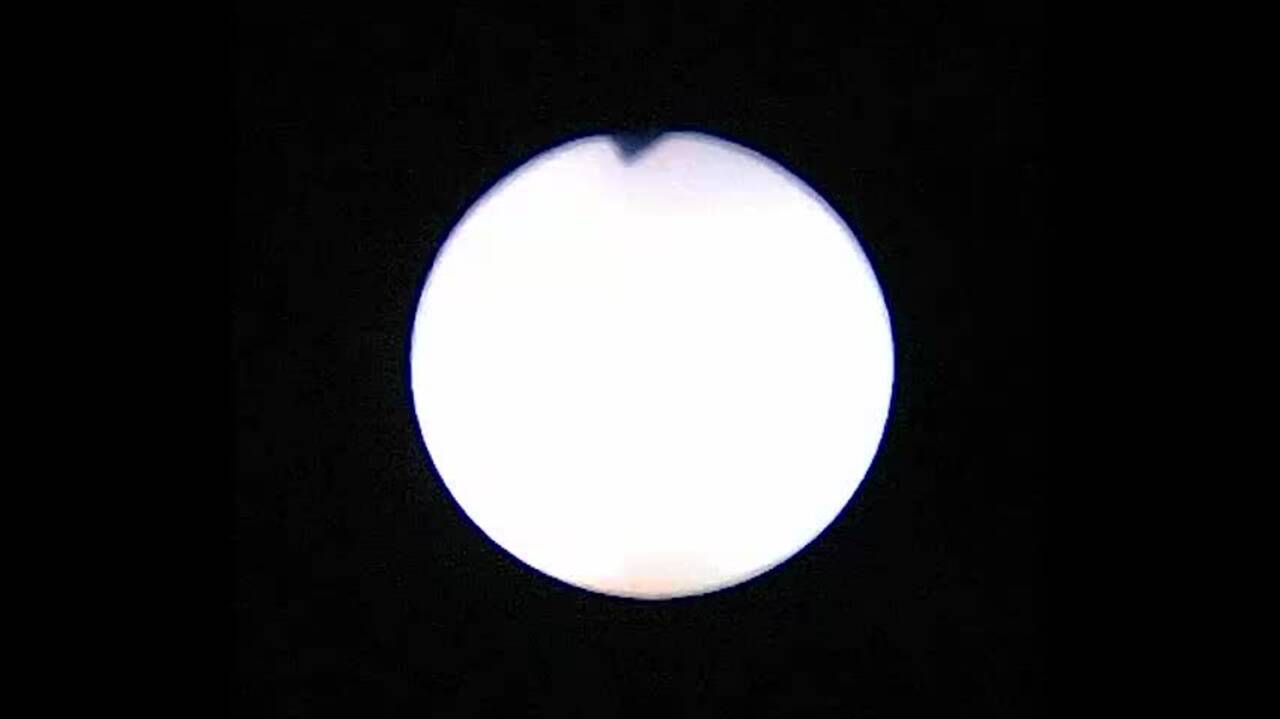 Cystoscopy to show remnants of original fistula (ROOF) - (No audio)