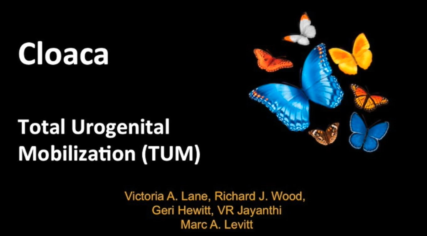 Cloaca Total Urogenital Mobilization (TUM)