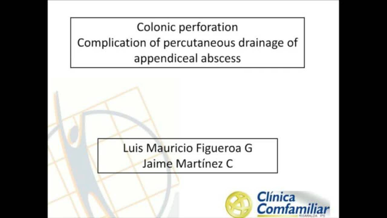 Tricks - Colonic Perforation, Complication Of Percutaneous Drainage Of...