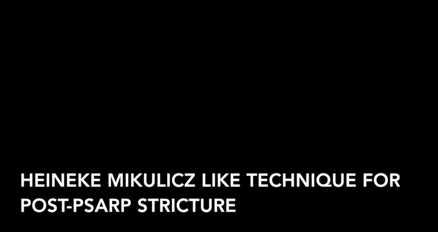 CCPR Heineke Mikulicz Like Technique for Post-PSARP Stricture (No audio)