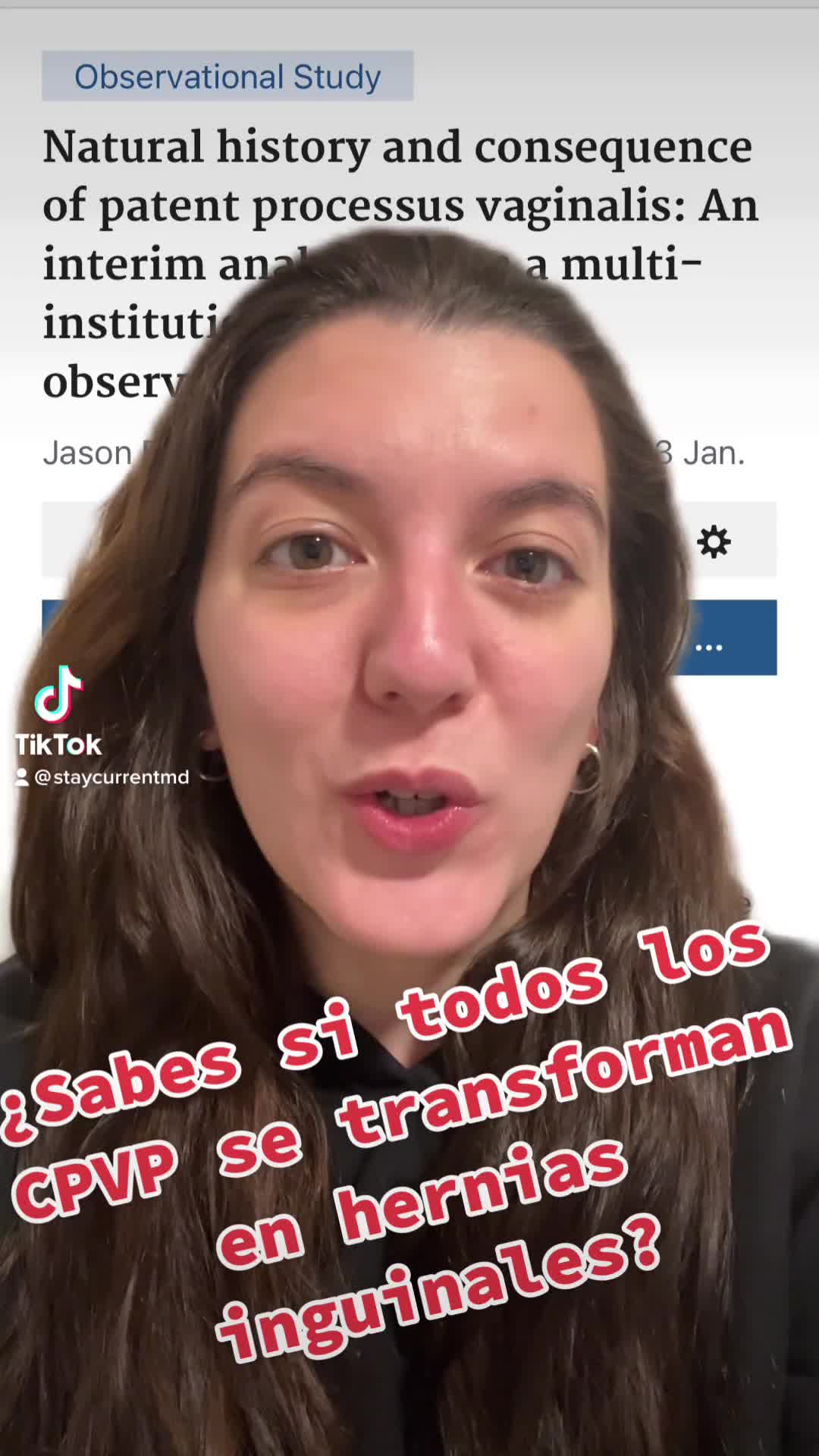 ¿Todos los CPVP se transforman en hernias inguinales?