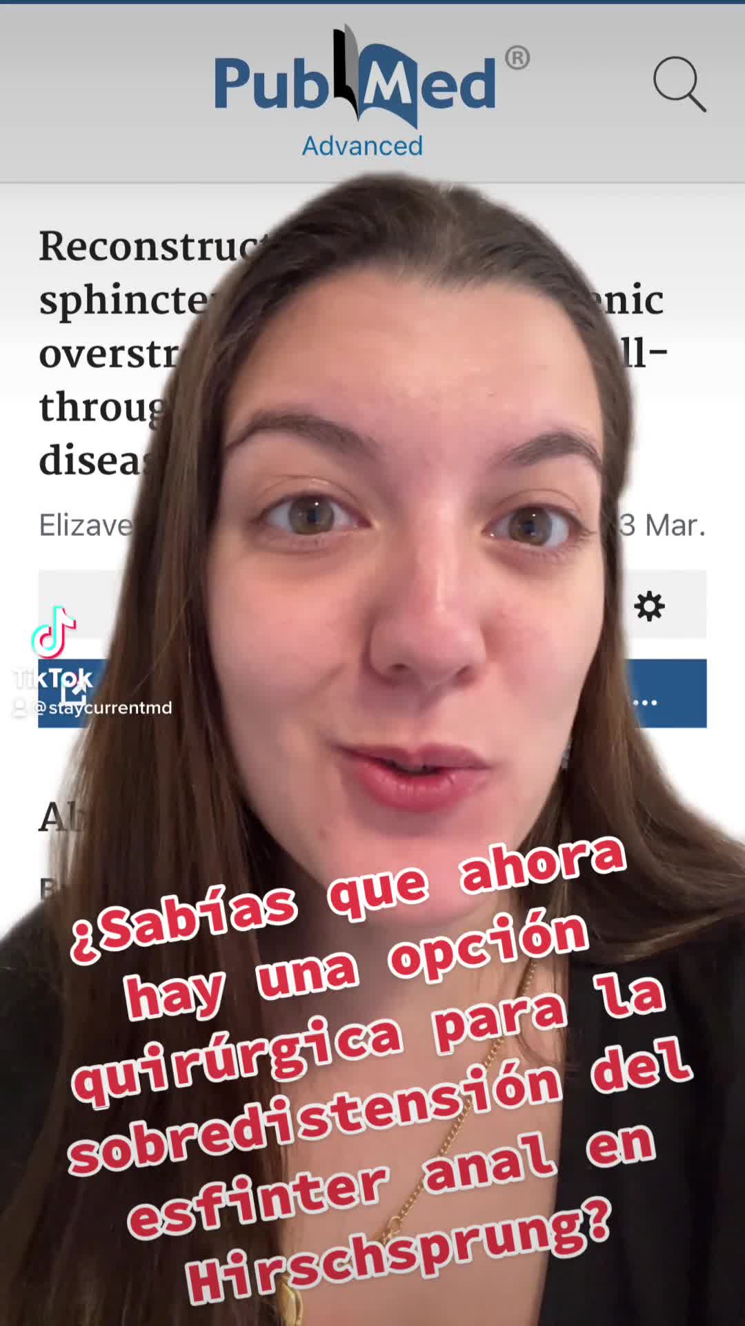 Reconstruyendo el esfinter anal sobre distendido luego de un descenso en pacientes con Hirschsprung