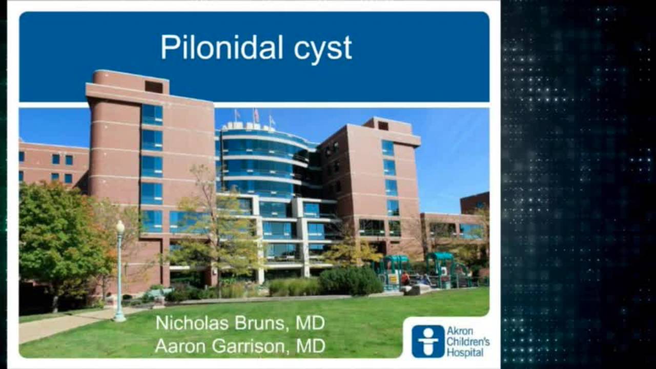 Pilonidal Disease - Aaron Garrison & Nicholas Bruns: Update Course 2014