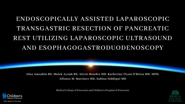 IPEG 2020 TOP ABSTRACT: Endoscopically Assisted Laparoscopic Transgastric Resection of Pancreatic Rest Utilizing Laparoscopic...