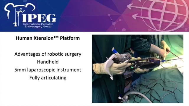 IPEG 2020 TOP ABSTRACT: First Laparoscopic Pediatric Nissen Fundoplication using the Human Xtensions Handheld Software-driven...