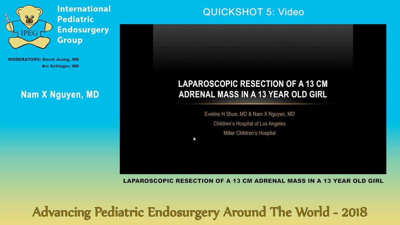 LAPAROSCOPIC RESECTION OF A 13 CM ADRENAL MASS IN A 13 YEAR OLD GIRL