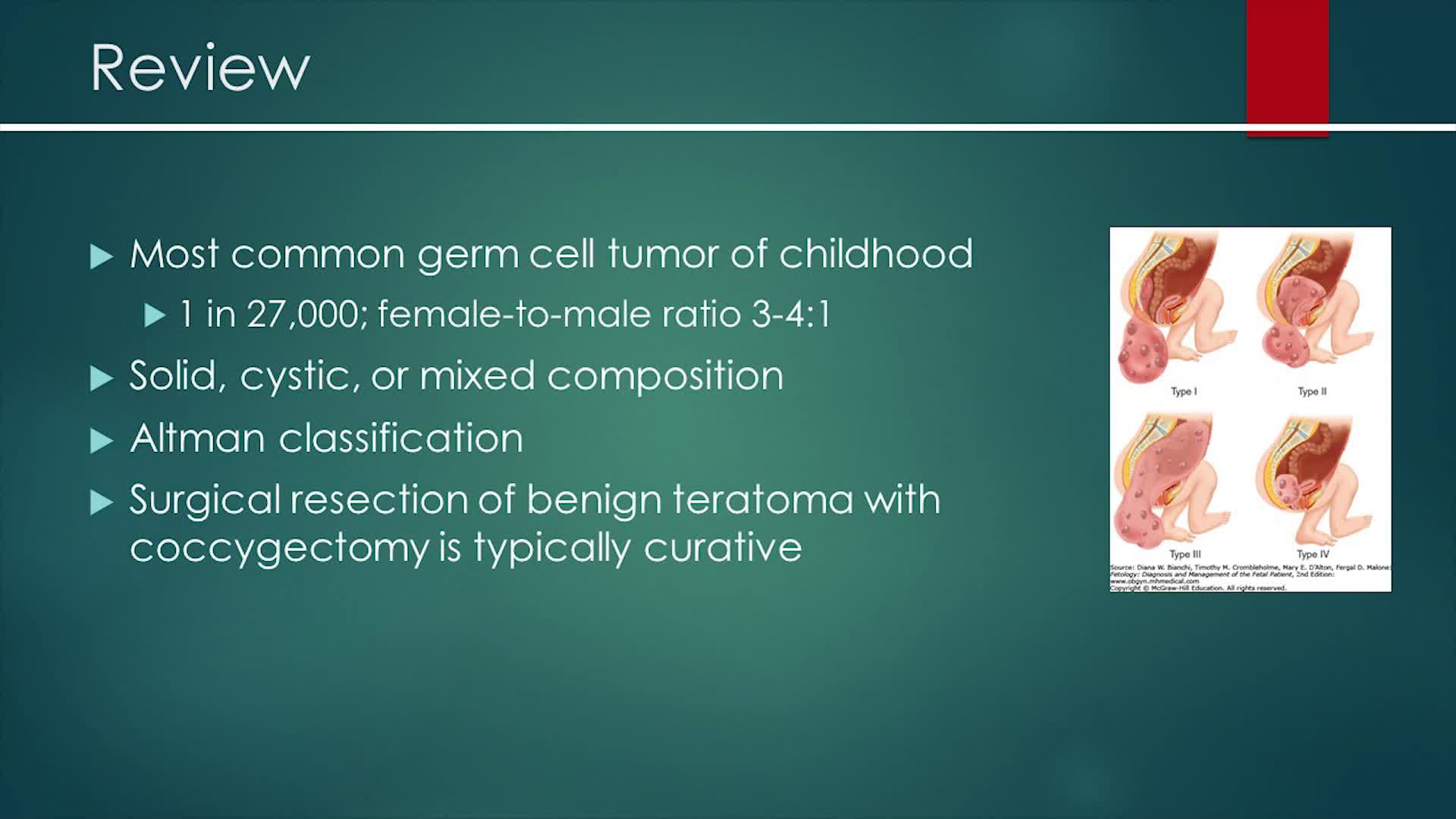 IPEG 2020 Top Abstract: Laparoscopic Assisted Excision of a Type III Sacrococcygeal Teratoma