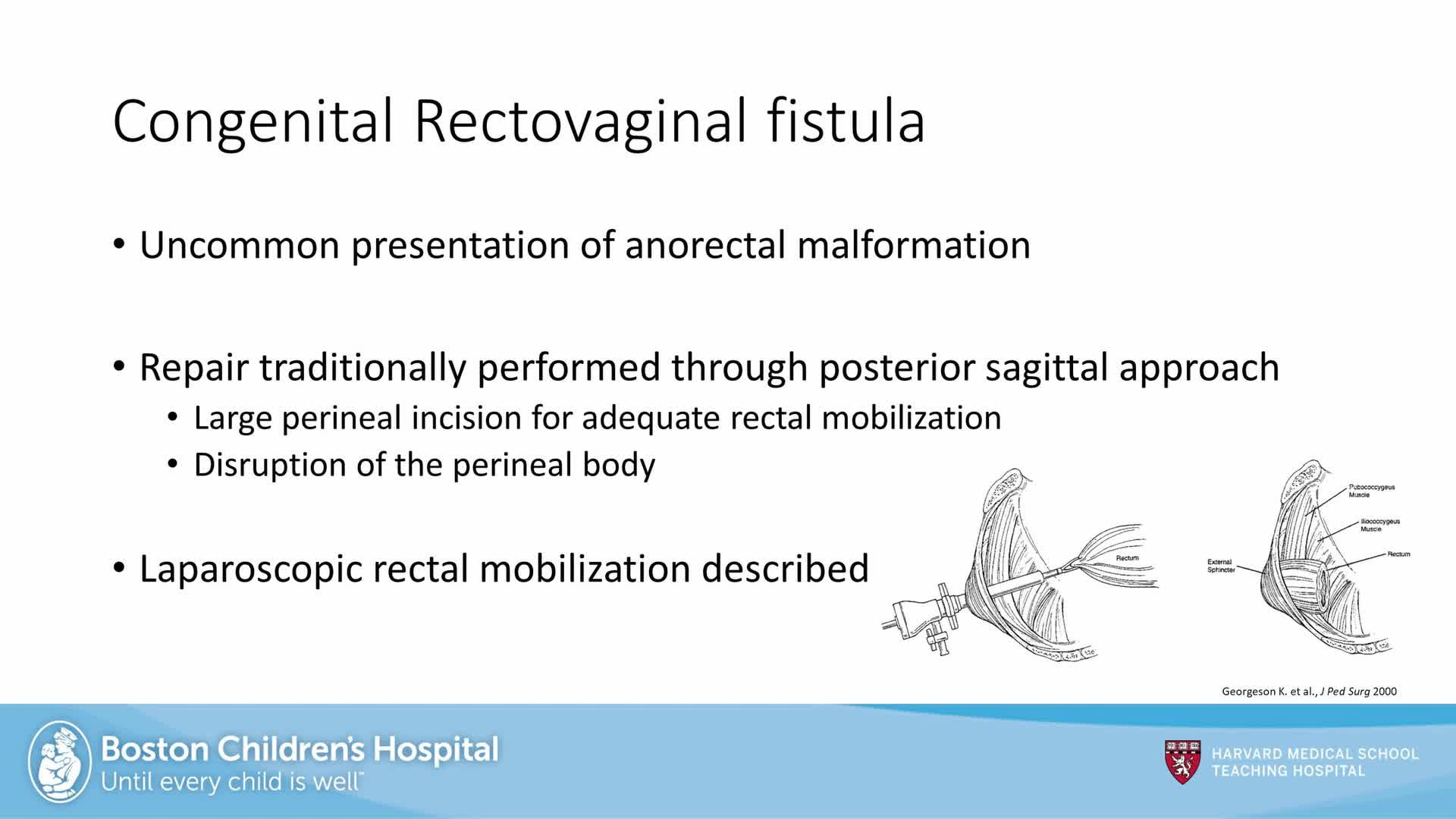 IPEG 2020 TOP ABSTRACT: Utilizing laparoscopy in rectovaginal fistula repair