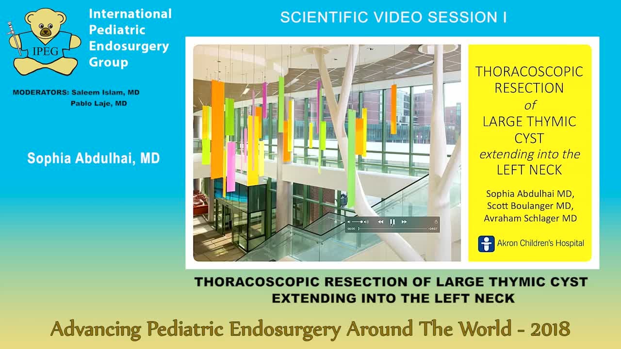 THORACOSCOPIC RESECTION OF LARGE THYMIC CYST EXTENDING INTO THE LEFT NECK