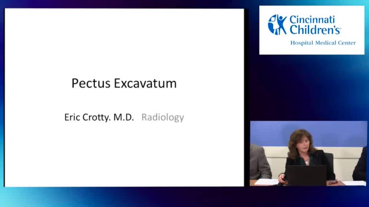 Pectus - Preoperative Assessment - Radiology and Cardiac Evaluation