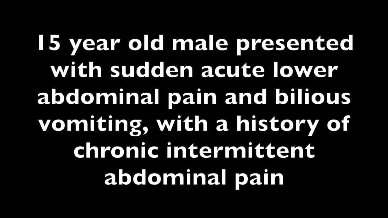 IPEG 2020 Top Abstract: Laparoscopic Left Mesocolic Hernia Repair