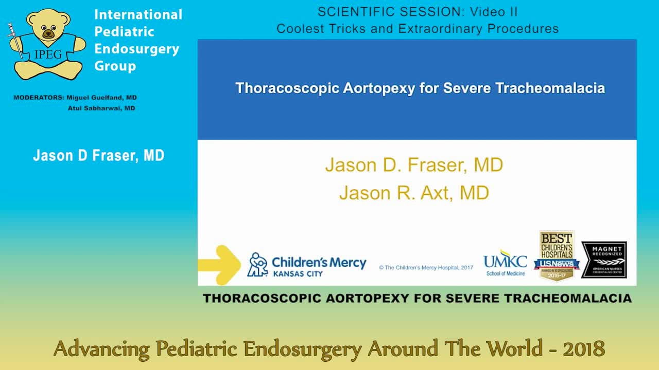 THORACOSCOPIC AORTOPEXY FOR SEVERE TRACHEOMALACIA
