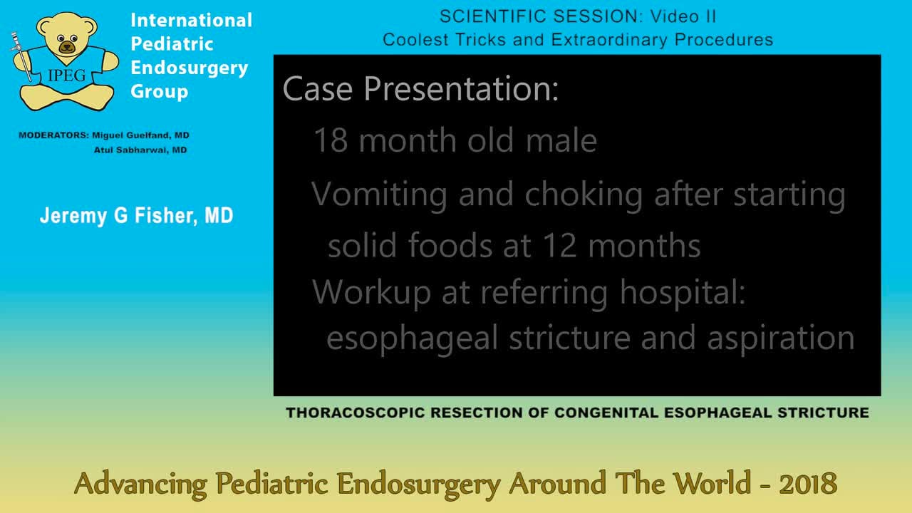 THORACOSCOPIC RESECTION OF CONGENITAL ESOPHAGEAL STRICTURE