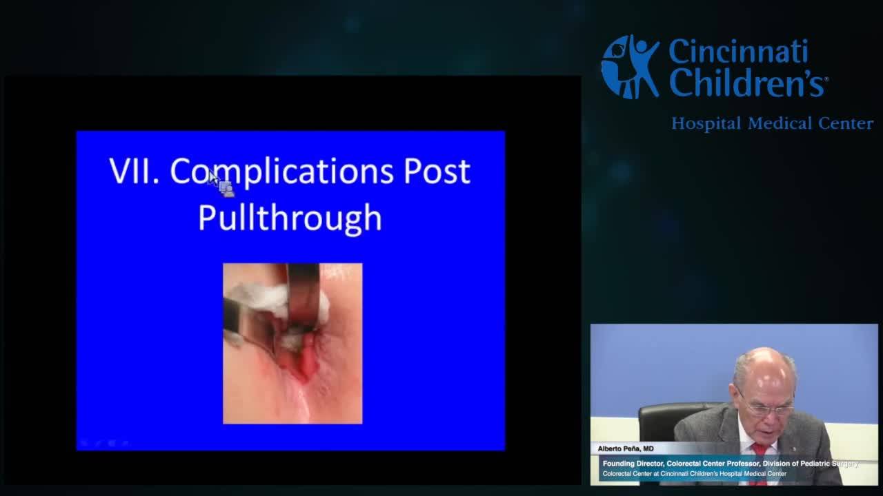 Outcomes and Complications in Hirschsprung Disease