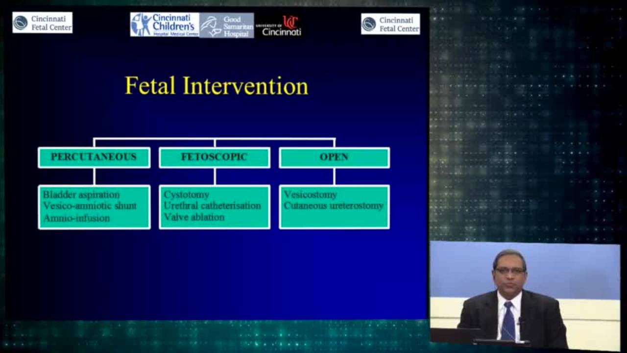 Urologic Fetal Intervention: Cincinnati Fetal Center