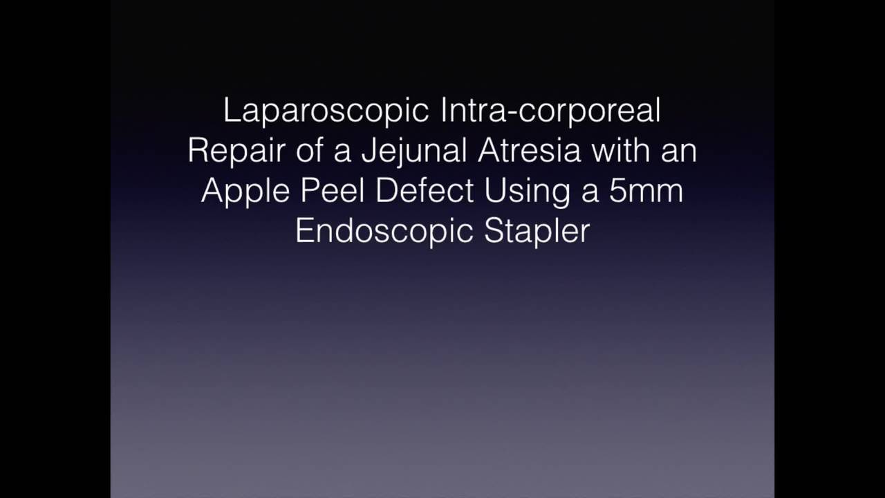 Laparoscopic Jejunal Atresia Repair - Technique