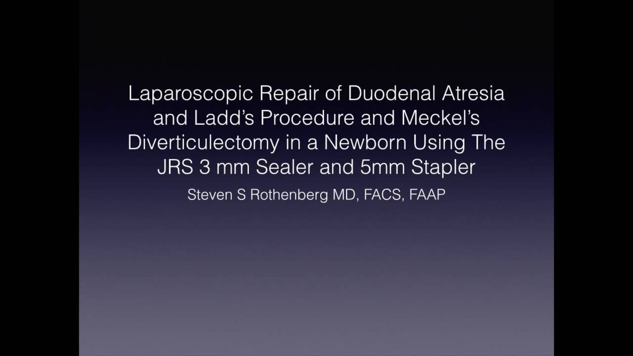 Technique: Laparoscopic Repair of Duodenal Atresia, Ladd's Procedure, and...