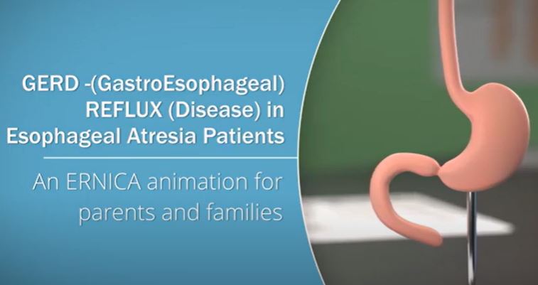 GERD - (GastroEsophageal) REFLUX (Disease) in Esophageal Atresia Patients: An ERNICA animation