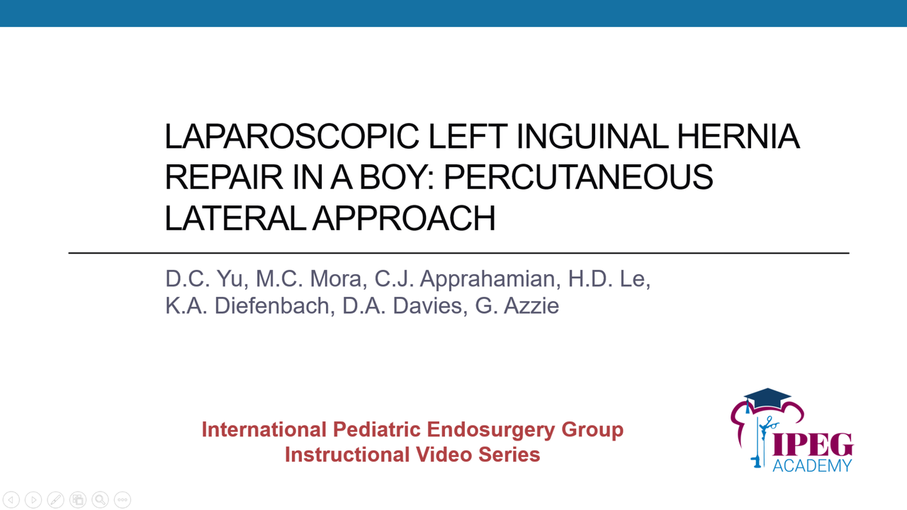 IPEG Academy: Laparoscopic Left Inguinal Hernia Repair in a Boy - Percutaneous Lateral Approach