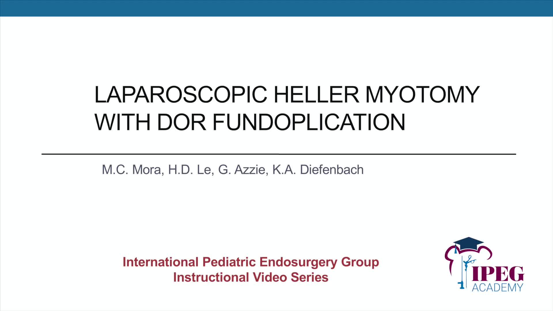IPEG Academy: Laparoscopic Heller Myotomy with Dor Fundoplication