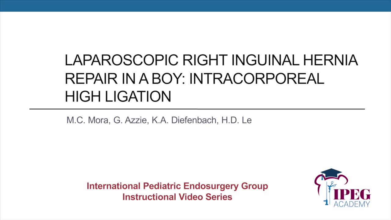 IPEG Academy: Laparoscopic Right Inguinal Hernia Repair in a Boy - Intracorporeal High Ligation