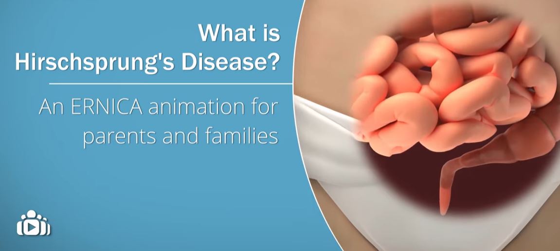What is Hirschsprung's Disease? An ERNICA animation for parents and families