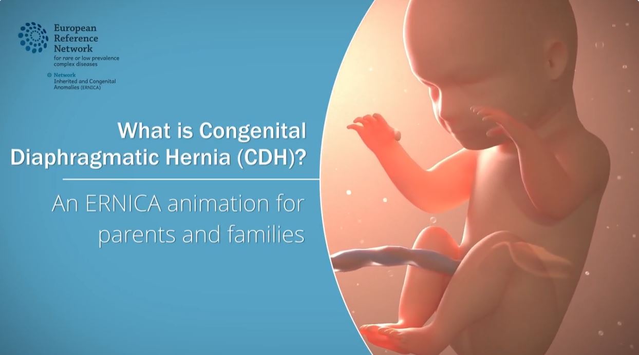 What is Congenital Diaphragmatic Hernia (CDH)? An ERNICA animation for parents and families
