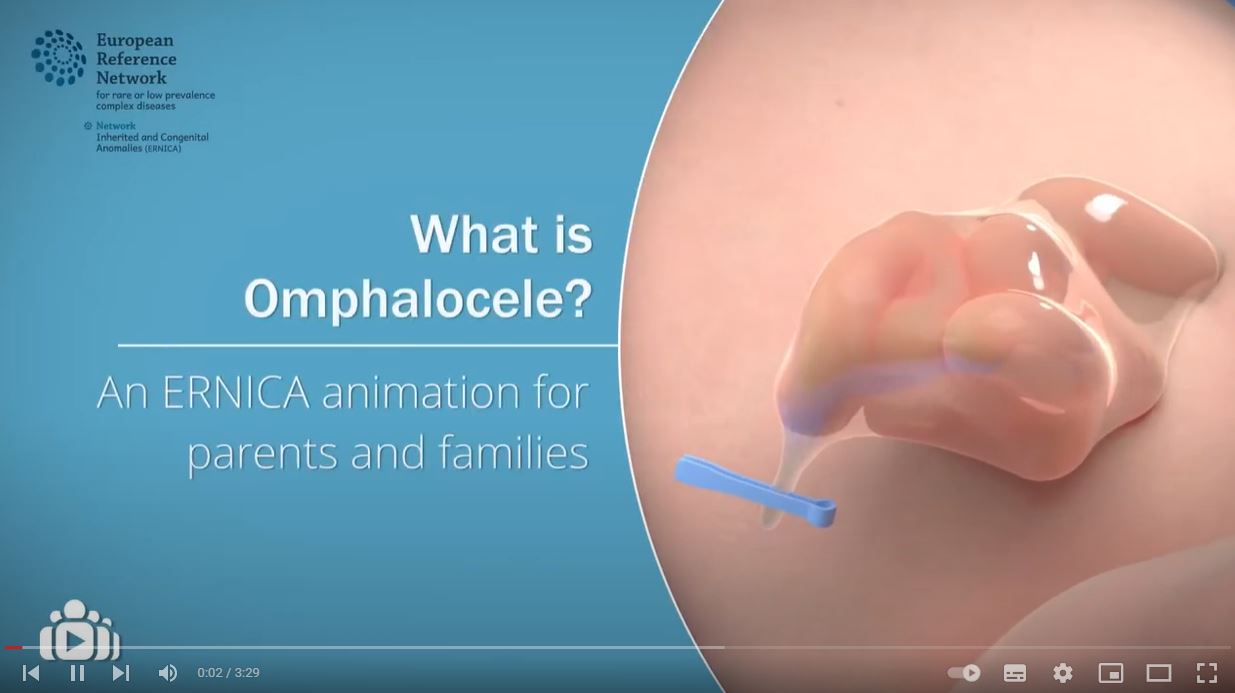 What is Omphalocele? An ERNICA animation for parents and families