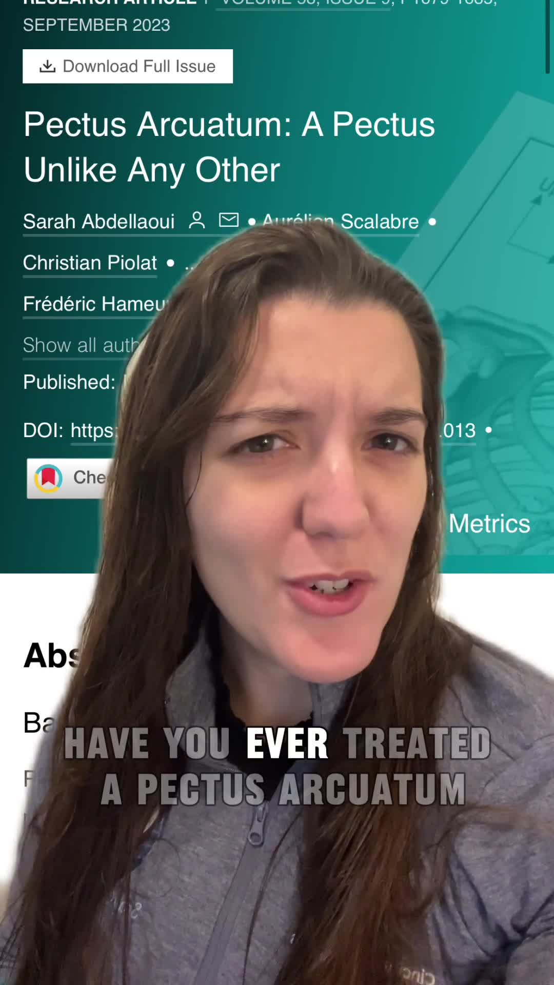 Pectus Arcuatum a Pectus Unlike any Other