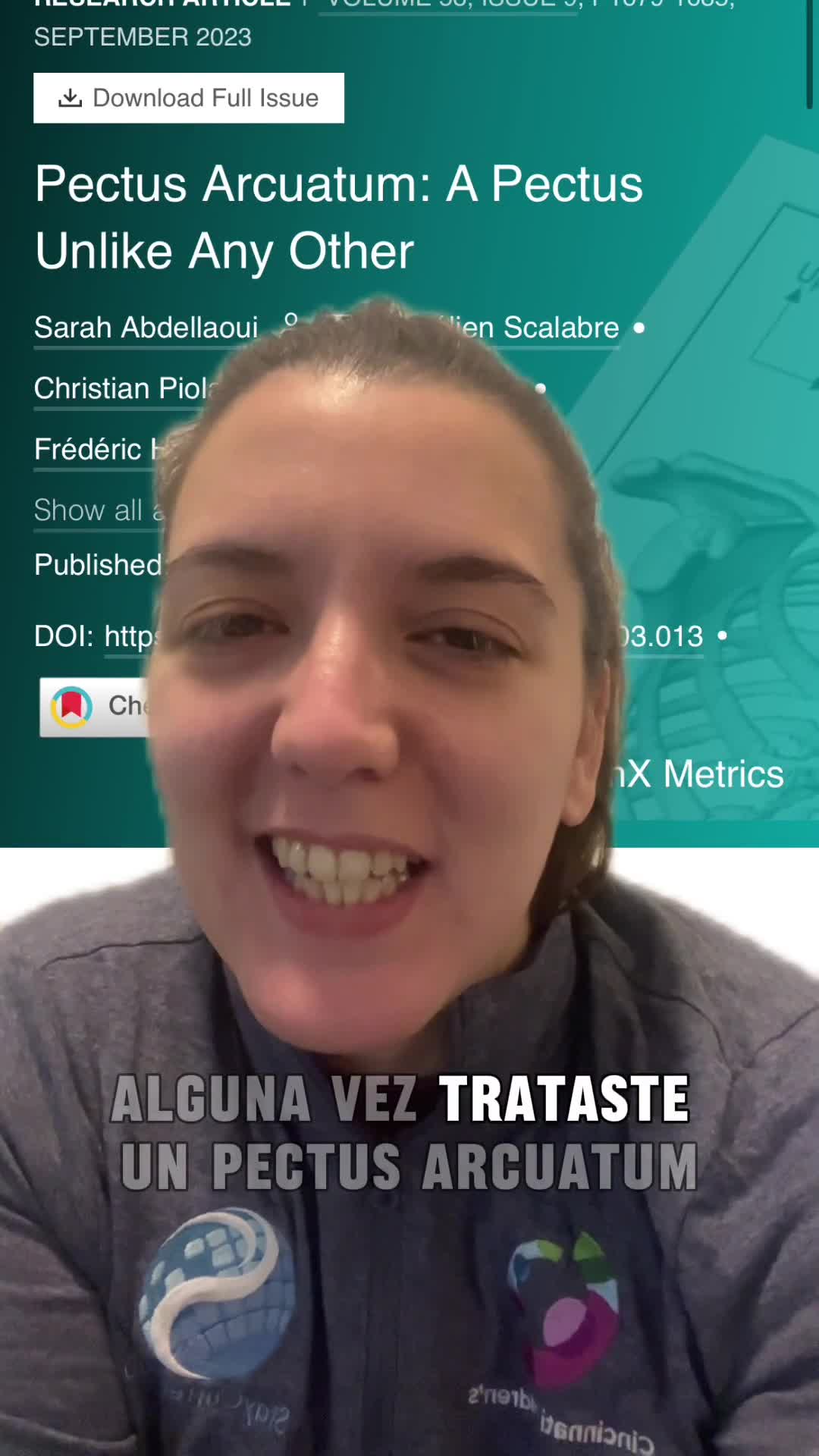 Pectus Arcuatum: un pectus como ningún otro