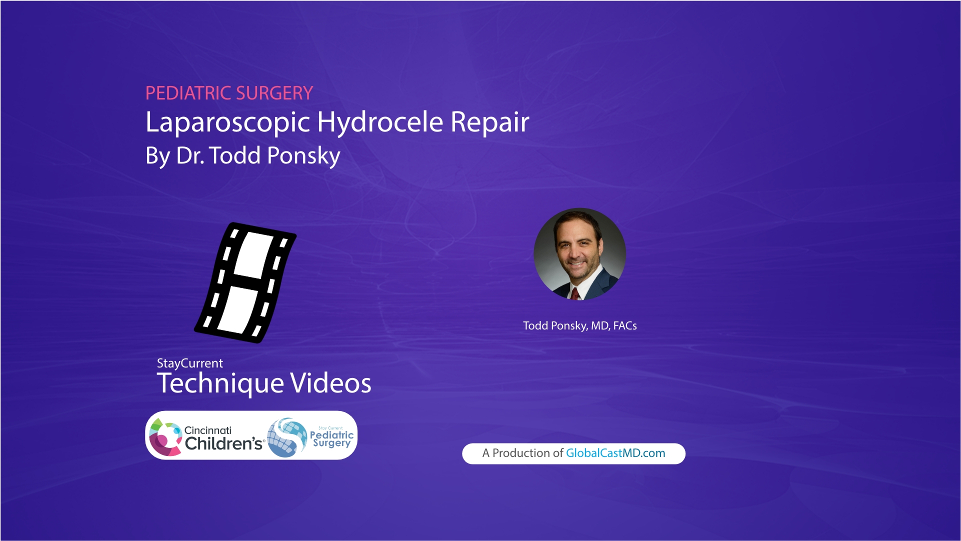 Laparoscopic Hydrocele Repair Technique