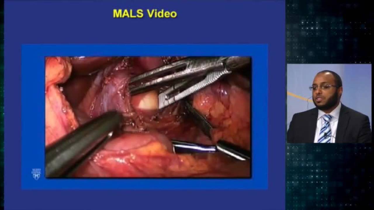Minimally Invasive Treatment of Median Arcuate Ligament Syndrome: Update...