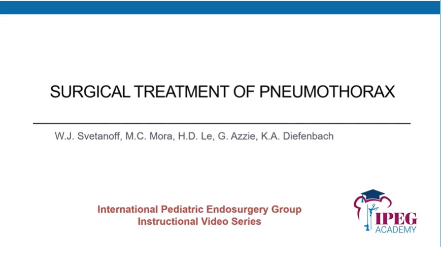 IPEG Academy: Surgical Treatment of Spontaneous Pneumothorax