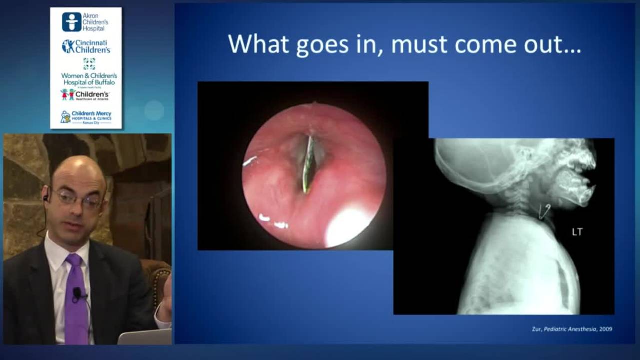 Airway and esophageal foreign bodies: Update Course 2015