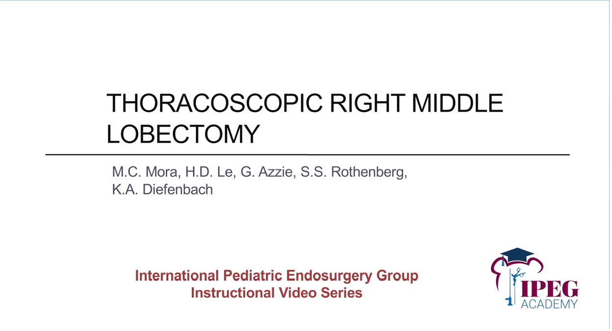 IPEG Academy: Thoracoscopic Right Middle Lobectomy