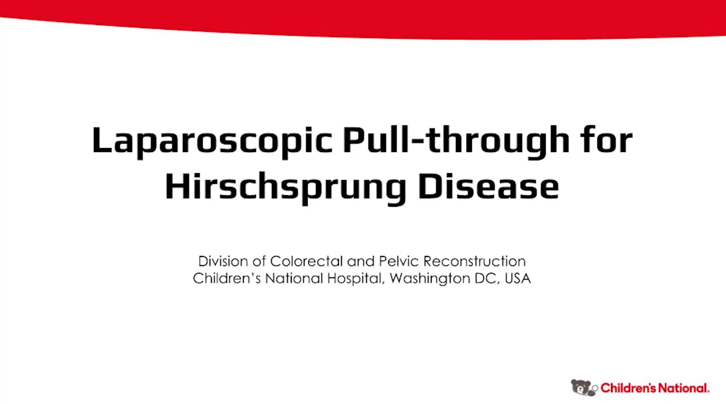 Laparoscopic pull-through for Hirschsprung disease updated 2024